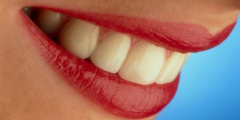 Approved Ways to Whiten Your Teeth Safely